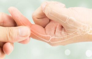 luxacao-nos-dedos-tratamento-clinica-da-mao-natal